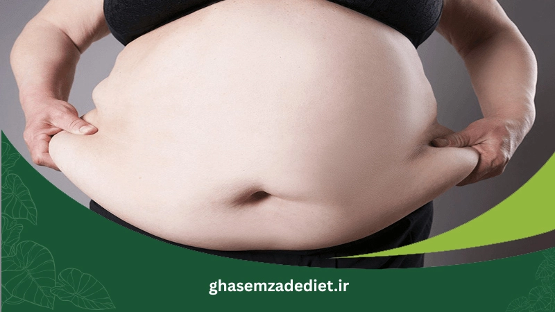 چاقی ژنتیکی (ارثی)